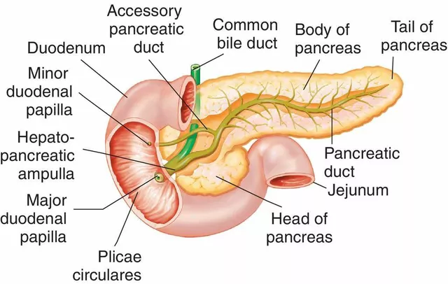 The Role of Stress in the Development of Pancreatic Duct Blockage